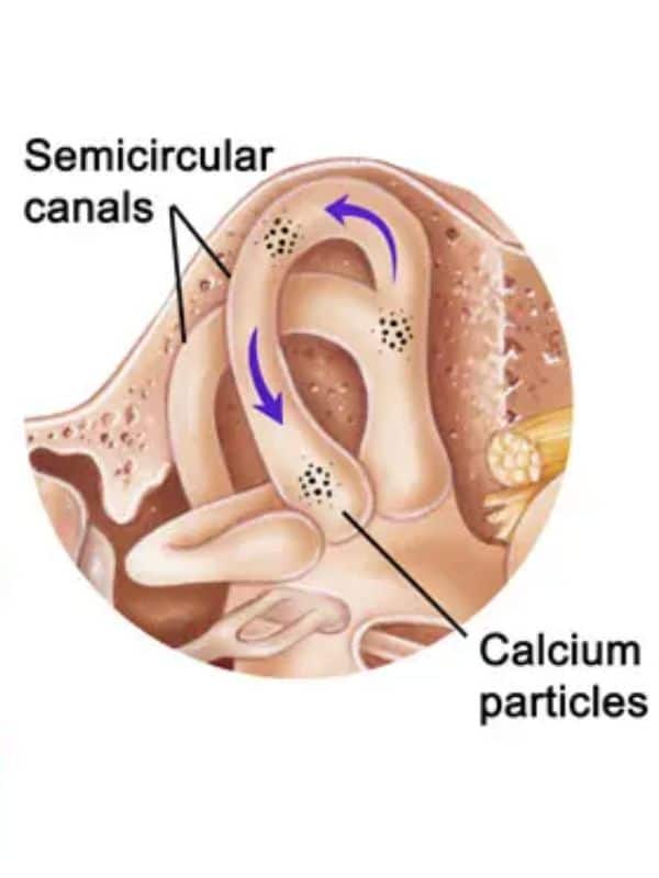 ear diagram