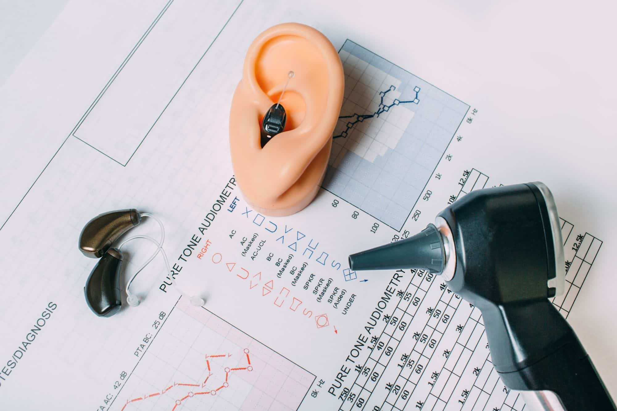 an audiogram with an otoscope and hearing aids sitting on top of it